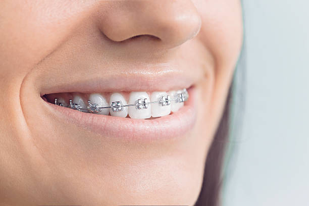 TMJ/TMD Treatment in Summit, IL
